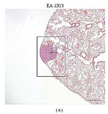 l'EA-2x/3 réduit de façon significative la superficie moyenne de la tumeur présente dans les sections transversales du poumon 