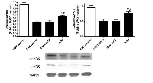 Les effets de l'acupuncture sur les expressions en eNOS et peNOS dans les tissus de l'aorte. L'acupuncture a considérablement amélioré les expressions eNOS et peNOS en comparaison au groupe témoin SHR et le groupe sham-acupuncture (acupuncture simulés). Les données ont été exprimées en moyenne ± SD. (Pour eNOS expression, * p &lt;0,001 pour ACU versus témoin SHR ; et # p=0,0053 pour ACU vs sham-acupuncture. Pour l'expression peNOS, p=,012 pour ACU vs contrôle SHR ; # P = 0,0073 pour ACU vs. sham-acupuncture). Pour de plus amples renseignements, voir article qui est distribué sous les termes de la Creative Commons Attribution 4.0 License International (http://creativecommons.org/licenses/by/4.0/) ; doi : 10.1186/s13020-016-0110-0.