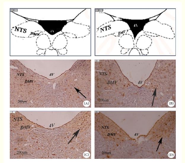 L'expression de c-fos dans DVC. (a) Microphotographies des sections médullaires montrant c-fos immunoréactivité dans le DVC (SNRC et DMV) chez les rats du modèle (A) et chez les rats avec EA à RN12 (B), BL21 (C), et RN12 + BL21 (D) . Les emplacements anatomiques des microphotographies sont indiqués en haut, adapté de l'atlas de Paxinos et Watson [30]. neurones c-fos-positifs sont présentées comme une coloration brun foncé dans les noyaux des cellules. Barres d'échelle : 200 um. 4 V : quatrième ventricule. (b) Densité optique intégré (IOD) des neurones c-fos-positifs dans le DVC. 